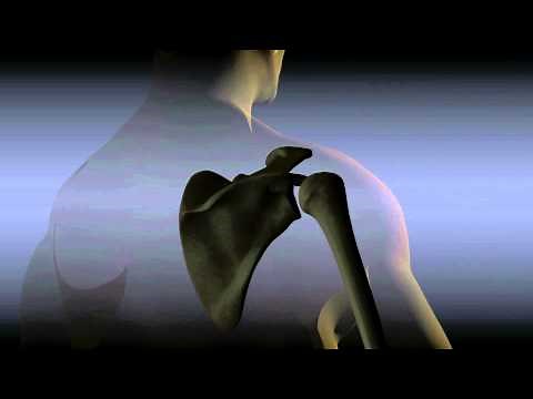 Subacromial Shoulder Injections