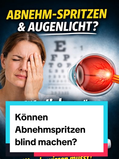 Können Abnehmspritzen blind machen – und wie hoch ist das Risiko wirklich? GLP‑1-Medikamente wie Wegovy oder Mounjaro verändern gerade das Leben von Millionen Menschen. Aber neue Studien werfen eine ernste Frage auf: Können sie blind machen? Im Fokus: eine seltene Sehnerv-Erkrankung namens NAION. Die Europäische Arzneimittelagentur stuft sie als sehr seltene mögliche Nebenwirkung von Semaglutid ein – etwa 1 zusätzlicher Fall pro 10.000 Behandelten. Was die Studien sagen: Manche Studien sehen ein