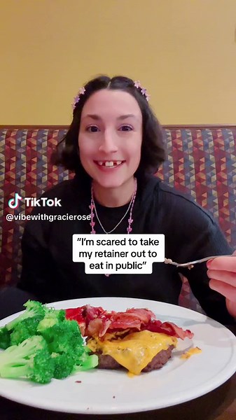 I was born with missing teeth. I had permanent temporary fake teeth in a dental bridge from 8th grade to a few days ago. my bridge broke and i did not go to the dentist right away and then my teeth shifted so now I need to do invisalign for 6 months before I can get the teeth implants #hypodontia #hypodontiaawareness #missingteeth #missingteethgang #missingtooth #invisalignjourney