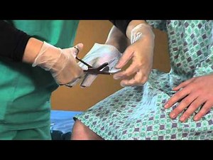 AQUACEL® Ag Burn - Glove alternative application