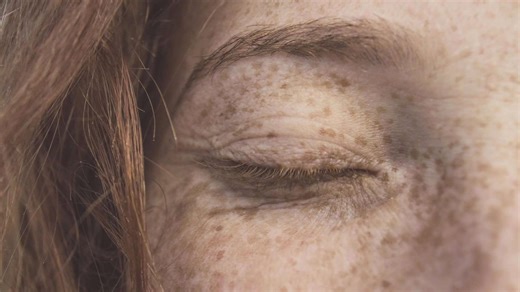 Post-inflammatory marks treatment approach