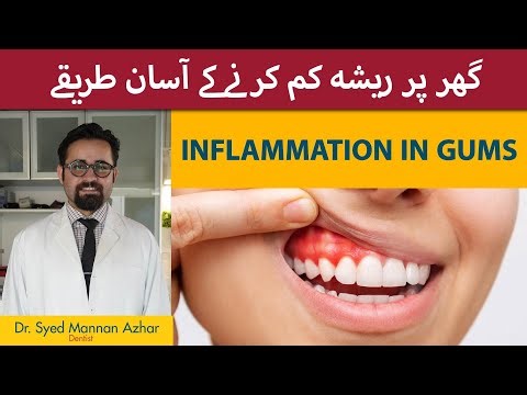 Gum Inflammation Relief | Masoodon Ki Sozish Kam Karne Ke Totkay | How to Treat Gum Infection