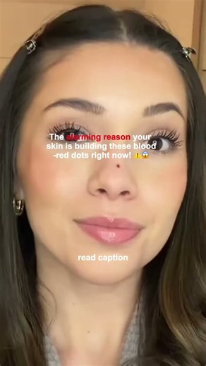 The alarming reason your skin is building these blood-red dots right now! 😱