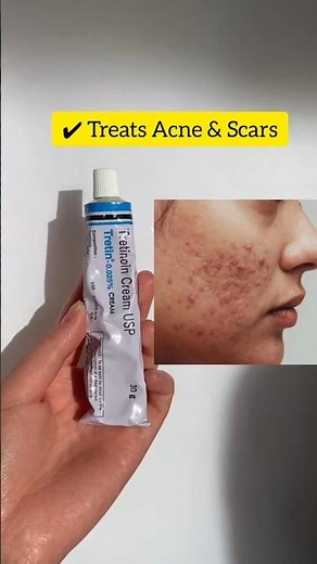 Tretinoin 0.025% Cream – Clear Skin Secret! #SkincareTips