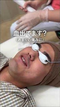 【メンズ脱毛】熊本院医師がヒゲ脱毛に挑戦してみました。湘南美容クリニック熊本院 #メンズ脱毛#ヒゲ脱毛