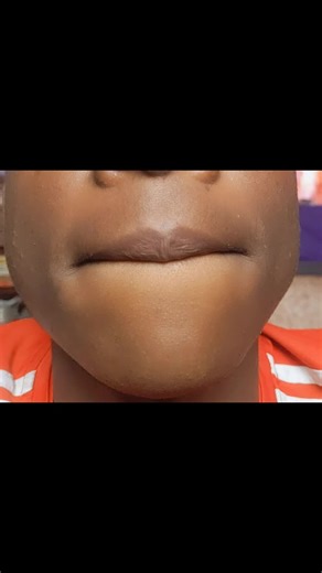 Pinck lips challenge