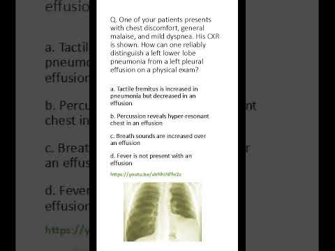 Medicine & Surgery MCQs (For MBBS, USMLE, MCCQE & PLAB)