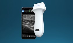 Accelerating Medical Imaging with Deep Learning | NVIDIA Technical Blog