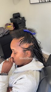#Alopecia cover up braids style for thinning hair or hair loss | SleekNbraids located Rockwall Texas