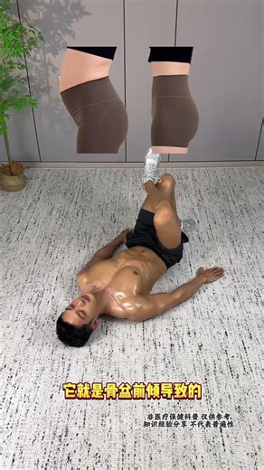 Boost Pelvic Anteversion: 5-Minute Bedtime Trick