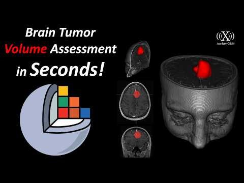 Brain Tumor Segmentation and Volume Assessment in 50 Seconds Using 3D Slicer