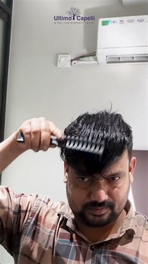 Ultimo Capelli | Non-Surgical Hair Replacement | Hair Patchs