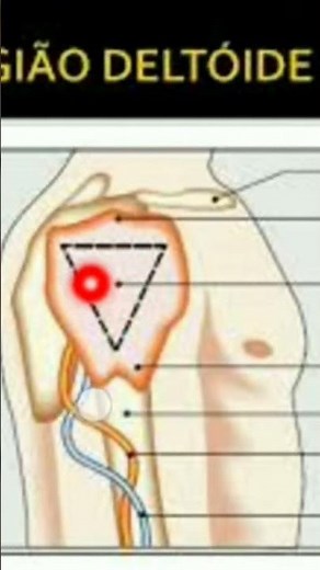 How to perform an intramuscular injection in the deltoid (shoulder) #nursing #nursingtechnician