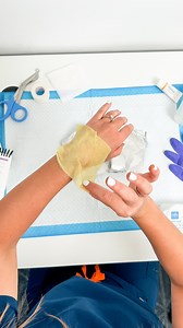 Wound care dressings explained🩸🩹💦 Aquacel AG ✨Infused with silver 🦠Fights infection 💦Absorbs fluid Xeroform ➡️Petroleum-based dressing 🦠Antiseptic properties 💦Provides moisture without sticking Duoderm CGF 💧Absorbs moderate ➡️ heavy drainage 💦Keeps wound moist Allevyn 🩹Foam dressing 💦Absorbs extra fluid #nurse #nursing #wound #woundcare #pressureinjury #BSN #RN #LPN #woundcarenurse | Nurse In The Making