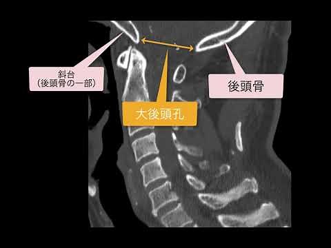 大後頭孔とは？位置・解剖をCT画像でチェック！