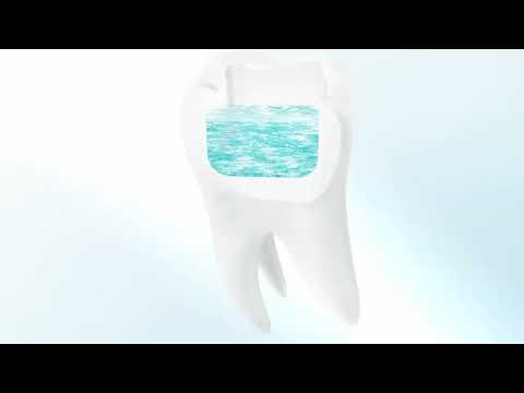 Learn how GC everX Posterior fibre reinforced composite extends the limits of direct restorations