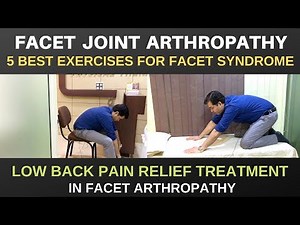 Facet Joint Arthropathy, L4-L5,L5-S1 Facet Joint Pain Relief Exercises, Facet Arthropathy Treatment