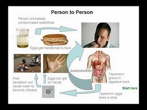 Cysticercosis and Neurocysticercosis: Who's At Risk?