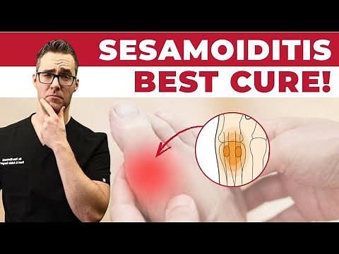 BEST Sesamoiditis Treatment [Big Toe Joint Pain & Big Toe Treatment]