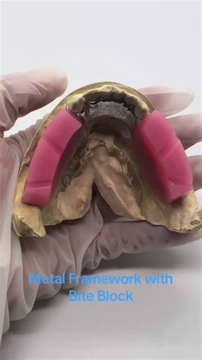 Metal Framework with Bite Block for Dental Labs
