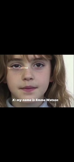TEETH TEST!! #hermionegranger #emmawatson #teethtest #fypシ゚viral #hogwartsismyhome