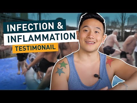 Inflammation | Wim Hof Method