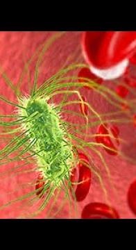 Septic Shock Pathophysiology