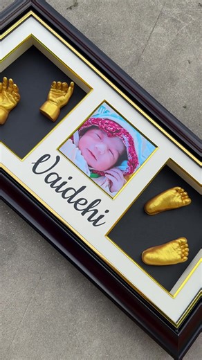 Hand and Feet Casting Services in Nepal