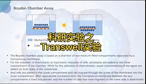 科研实验之：Transwell实验！