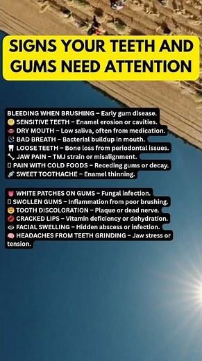 SIGNS YOUR TEETH AND GUMS NEED ATTENTION #dentalcare #oralhealth #gumhealth