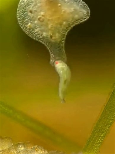 The Microscopic World of Amoeba Hunters