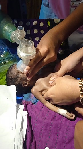 39K views · 1.9K reactions | New born baby resuscitation #newborn #nicu | Medical practice | Facebook