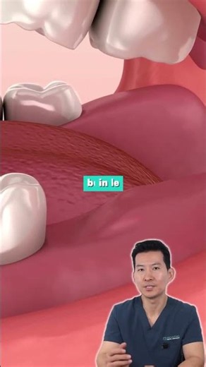 Why Wisdom Teeth Can Cause Pain and Damage #shorts