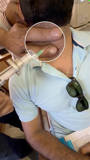 🔬 Cells don’t lie – FNAC diagnosis! #science #pathology #fnac #neck