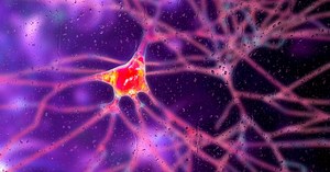 Scientists Just Announced the First Real Treatment for Huntington’s Disease