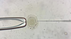 View through microscope at in vitro fertilization process