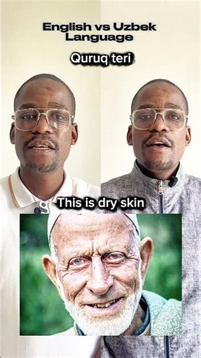 American English Vs Uzbek Language (Skin Problems) #fypシ #englishvocabulary #learnenglish