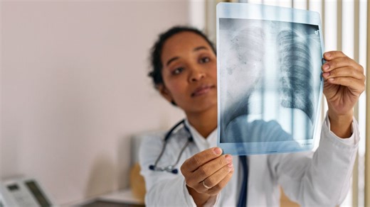 Understanding Small Cell Lung Cancer: Stages, Treatment and Side Effects | CURE