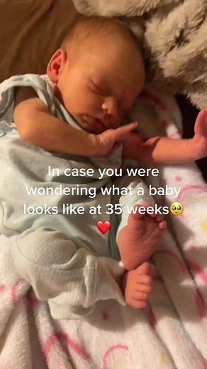35 Week Baby Development: What a 5lbs 3oz Newborn Looks Like
