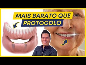 OVERDENTURE (REMOVABLE PROSTHESIS WITH IMPLANTS): HOW DOES IT WORK?