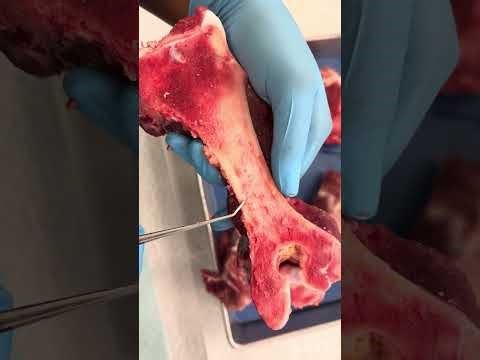 Lab Activity: Bone Dissection and Identification