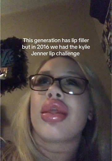 The Kylie Jenner Lip Challenge: A 2016 Beauty Trend