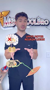 176K views · 31 reactions | Memorize Upper vs. Lower Motor Neuron Lesions in 30s! 易❌ Save this for your exams! #medstudent #medschool #medicalstudent #neuro #neurology #usmle | Medschoolbro | Facebook