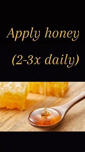 Painful mouth ulcers? 😣Try these simple care tips for faster relief.Follow for more ✨....