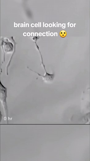 Exploring Brain Cells Under the Microscope