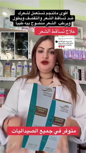 علاج تساقط الشعر: أفضل شامبو وطرق فعالة