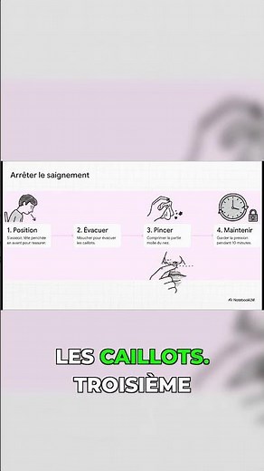 Comment arrêter un saignement de nez (la VRAIE méthode)