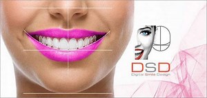 Digital Smile Design (DSD) Course %