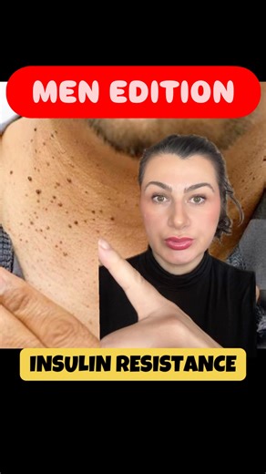 Suzana | Metabolic Reset Coach on Instagram: "[👇 Comment MEN and I’ll send you exactly where to start.] Most men don’t realize this has nothing to do with testosterone… and everything to do with insulin. If you’re dealing with: • Belly fat that won’t move • Low energy • Brain fog • Low libido or performance issues • High triglycerides / low HDL • High blood pressure These are not “just aging.” They’re classic signs of insulin resistance — and it’s the real root problem behind most modern chroni