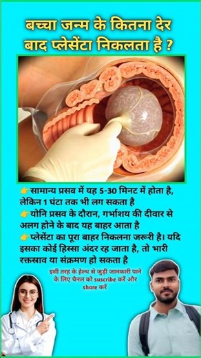 How long after birth does the placenta come out? Placenta removal techniques || #viral #placenta